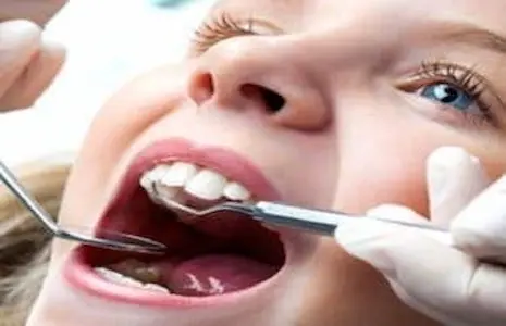 Dentista per bambini Roma carie