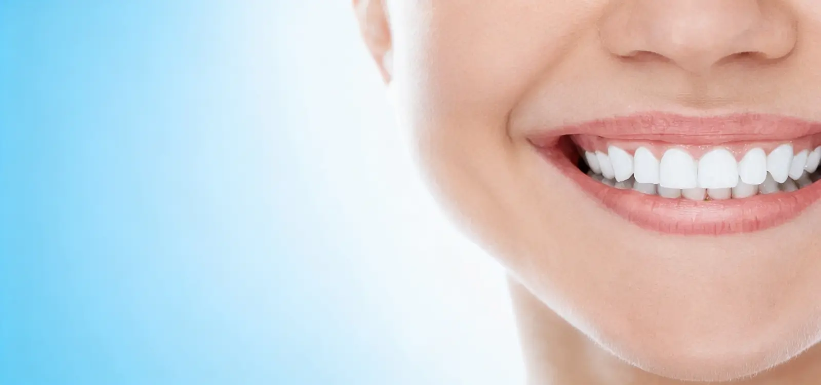 Sbiancamento denti Roma